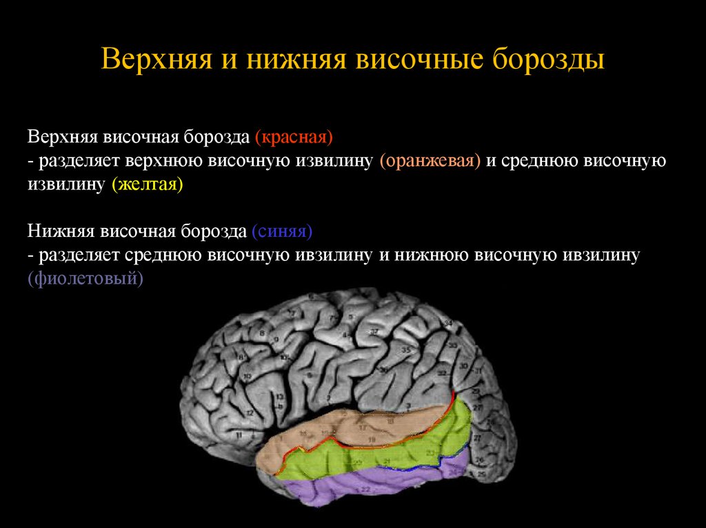 Значение извилин головного мозга. Задние отделы верхней височной извилины. Верхняя височная височная извилина. Борозды височной доли головного мозга.