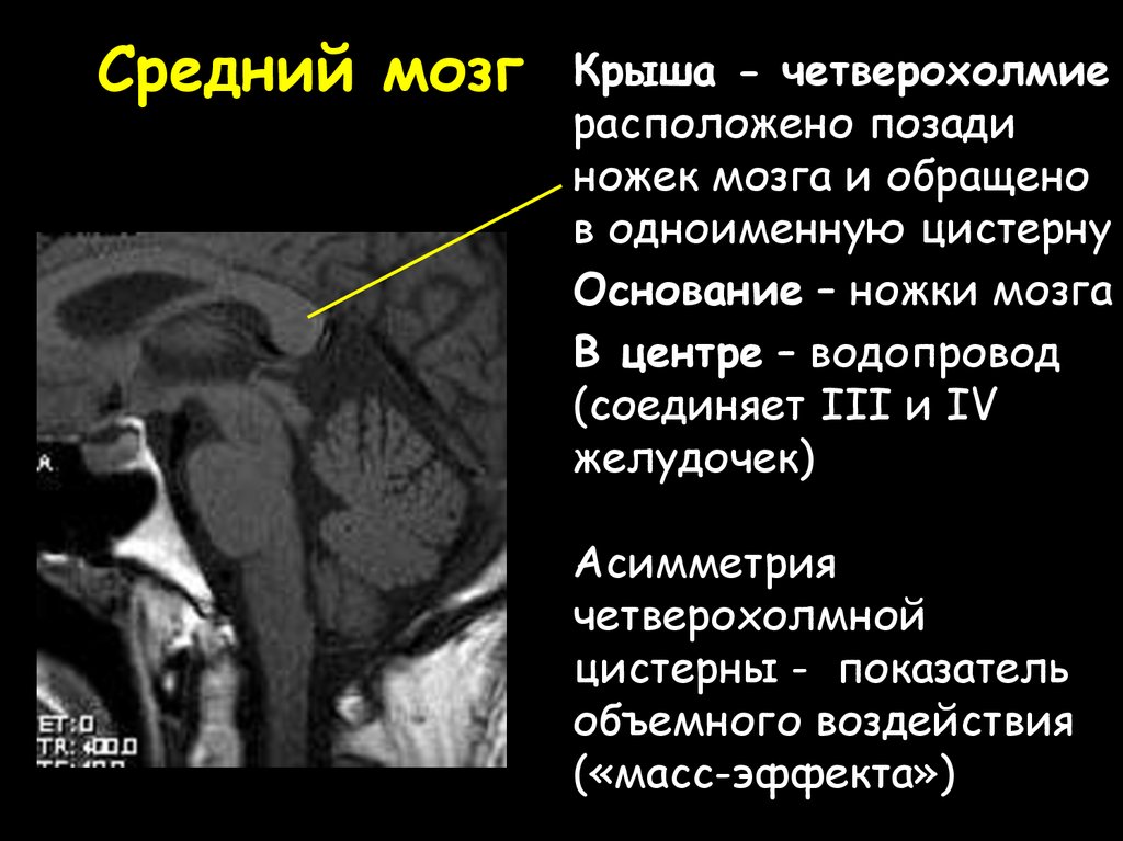 Четверохолмная цистерна