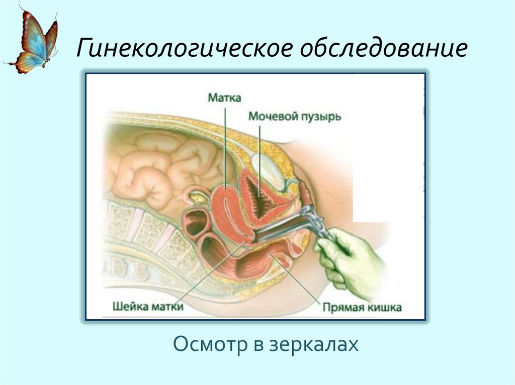 Осмотр матки. Влагалищное исследование в зеркалах. Осмотр в зеркалах гинекология методика. Гинекология обследование с помощью зеркал. Влагалищное исследование в гинекологии.