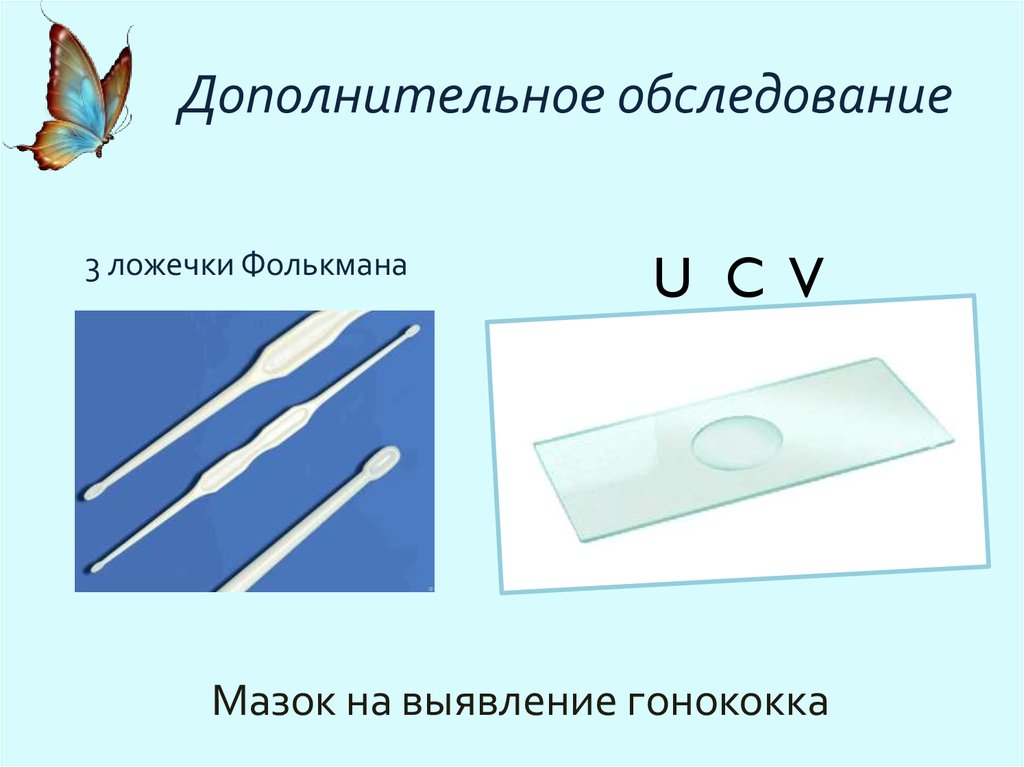 Хирургическая ложка фолькмана рисунок