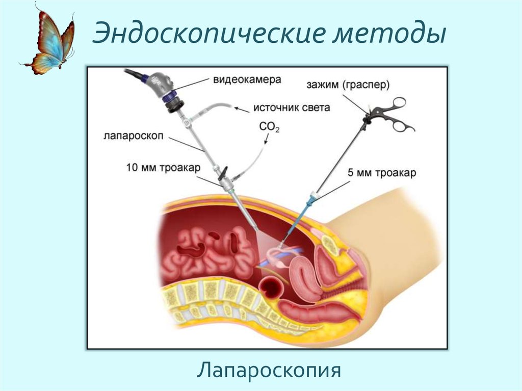 Метод эндоскопии