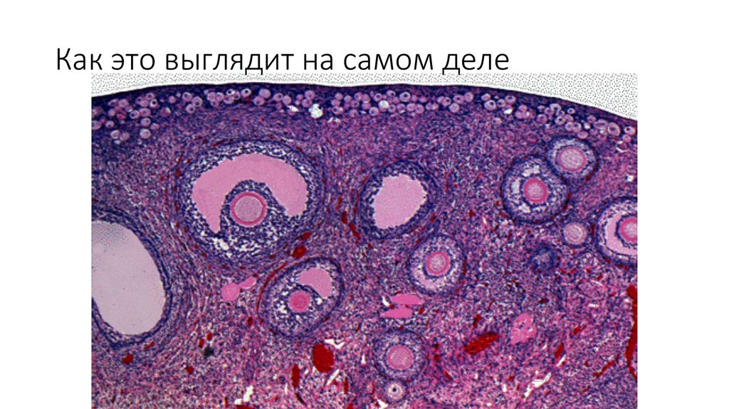 Как это выглядит на самом деле