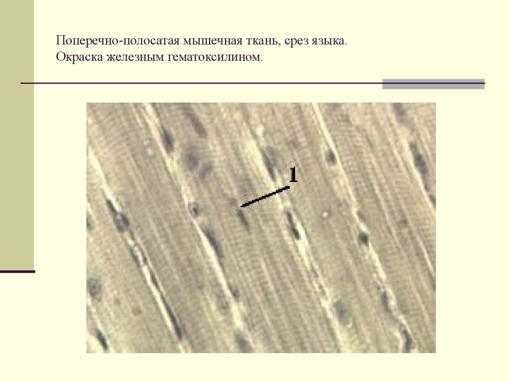 Ткань языка. Окраска железным гематоксилином мышечной ткани. Поперечно полосатая мышечная ткань окрашенная гематоксилином. Поперечно полосатая мышечная ткань окраска Железный гематоксилин. Поперечнополосатая мышечная ткань Железный гематоксилин.