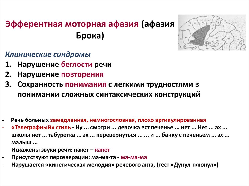 Афферентная афазия. Клинические проявления Афферентно-моторной афазии. Признаки моторной афазии. Эфферентная моторная афазия симптомы. Синдром афферентной моторной афазии.