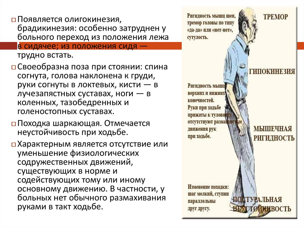 Ригидность мышц. Центральный пирамидный паралич. Мышечная ригидность и тремор это.