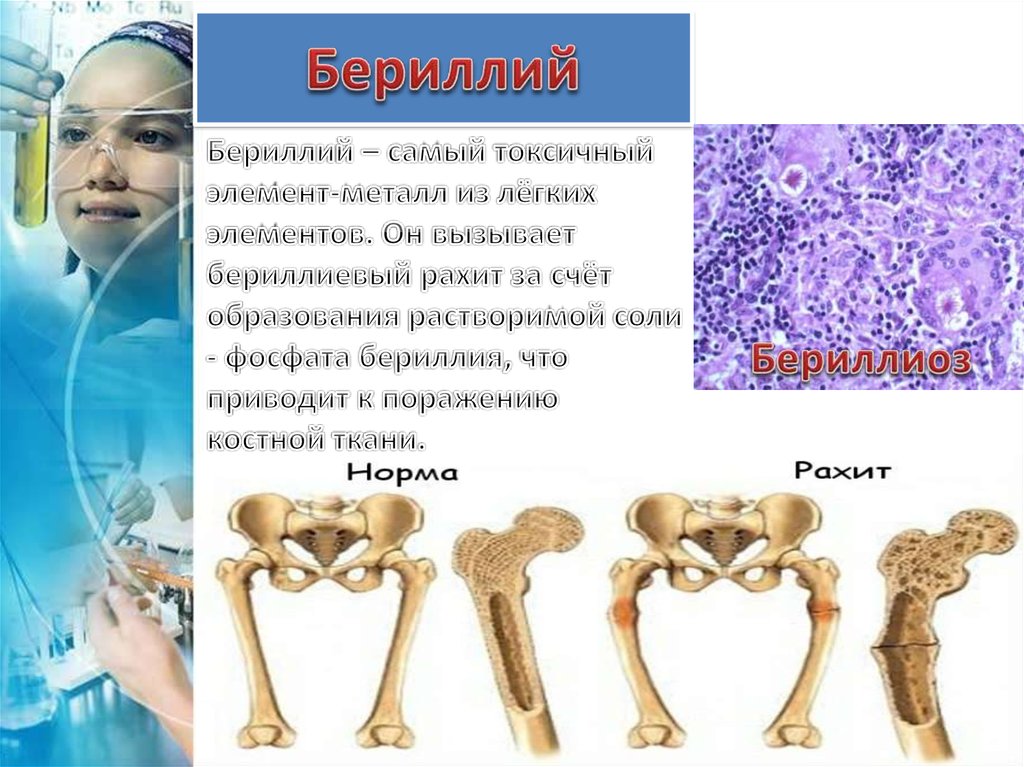 Самый токсичный элемент. Самый токсичный элемент. Ядовитые элементы. Самый токсичный элемент. Таблицы солей тяжелых металлов.