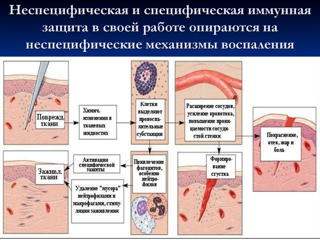 Схемы воспалительную реакцию тканей на внедрение микробов