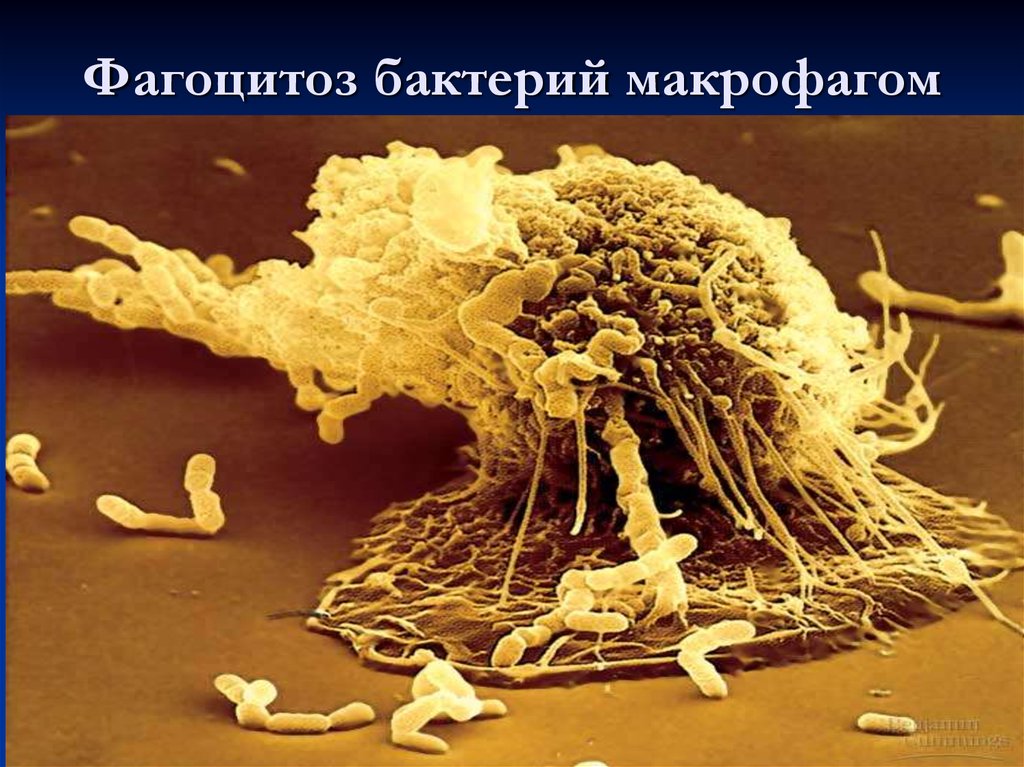Активность макрофагов. Макрофаги Мечников. Фагоциты под микроскопом Мечников. Фагоцитоз микрофаги и макрофаги. Макрофаг фагоцитоз бактерию.