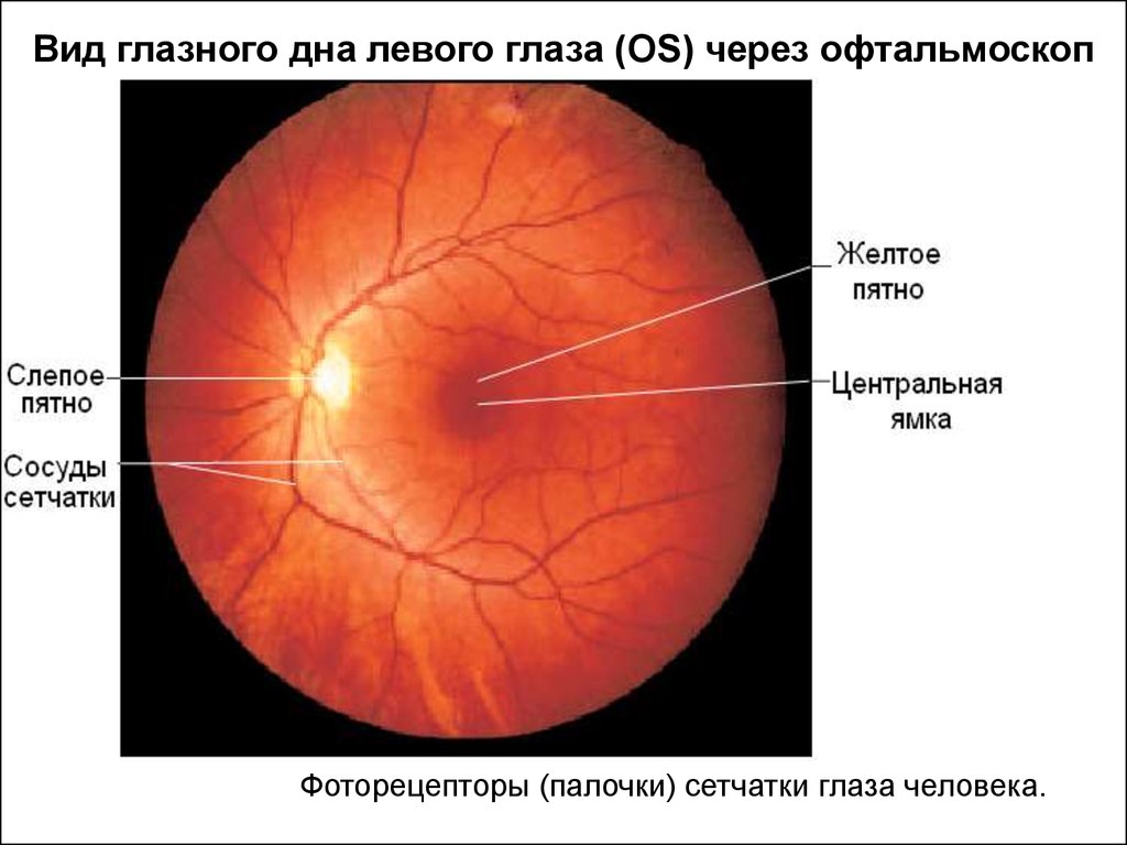 Функция сетчатки глаза человека. Слепое пятно офтальмология. Желтое и слепое пятно сетчатки глаза. Функция сетчатки глаза желтое пятно. Центральная ямка желтое пятно сетчатки.