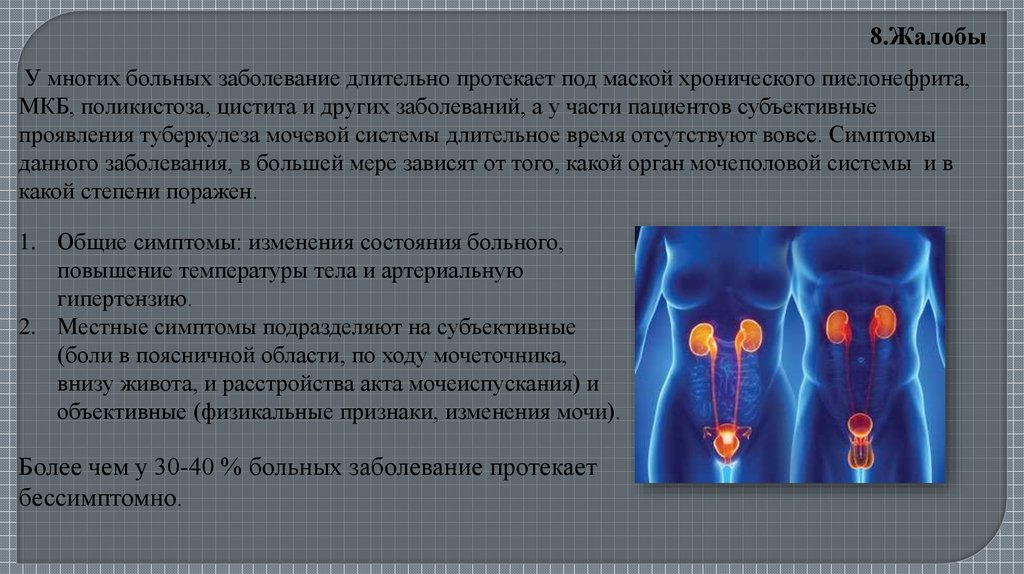 Презентация туберкулез мочевыделительной системы