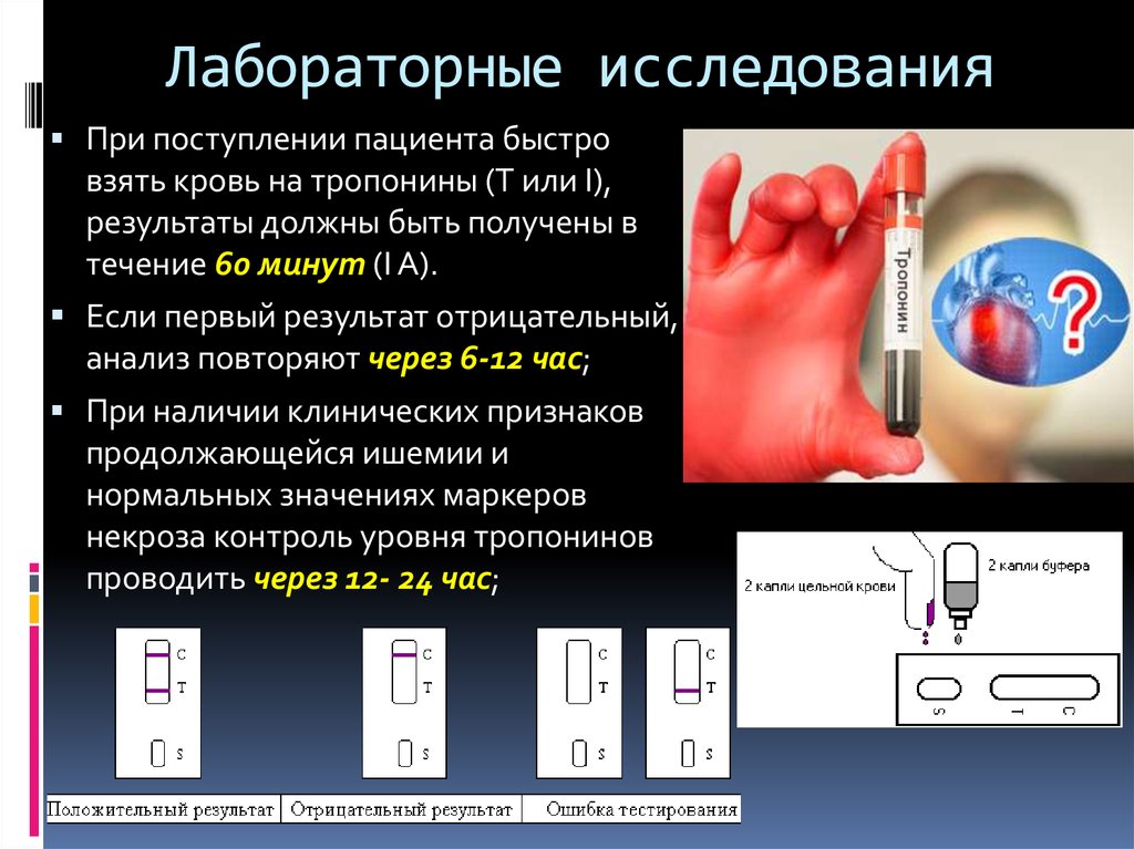 Тест на окс