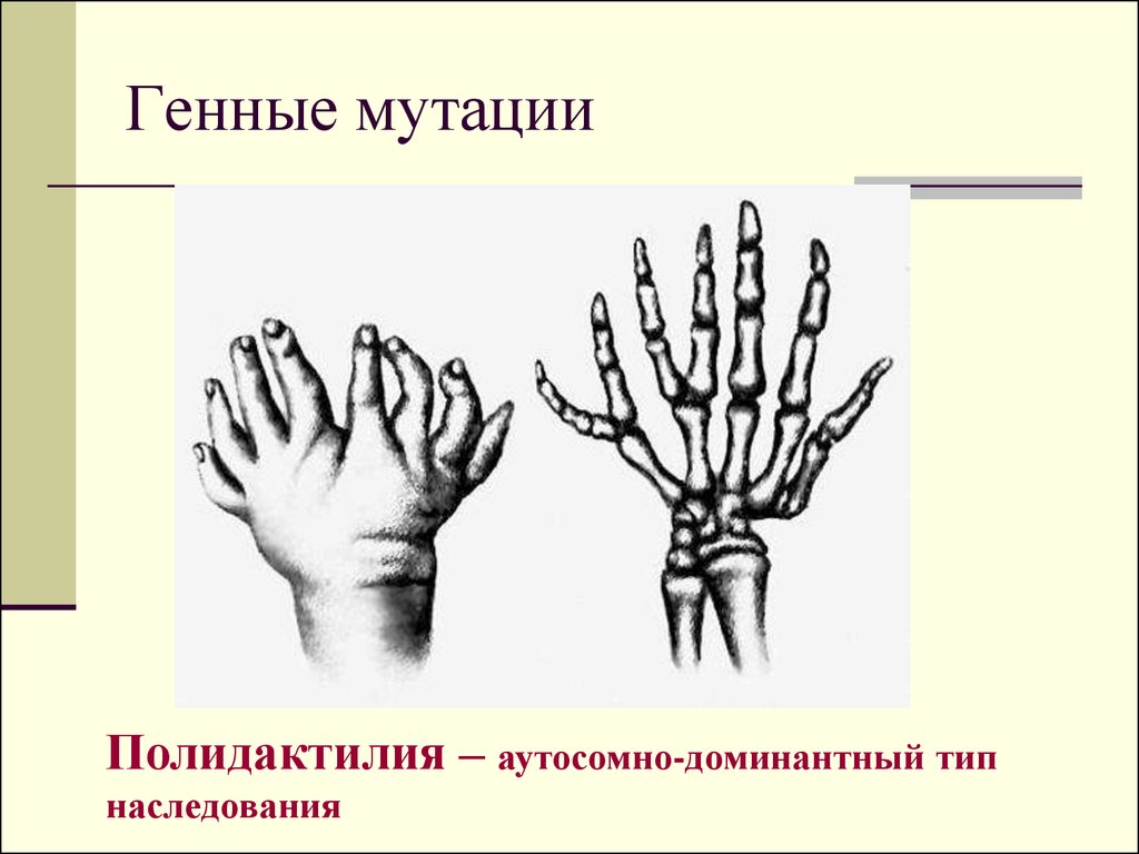 Геномные мутации человека презентация