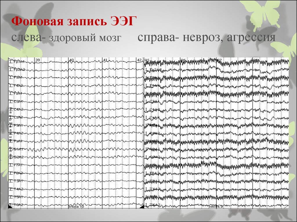 Центральная ээг