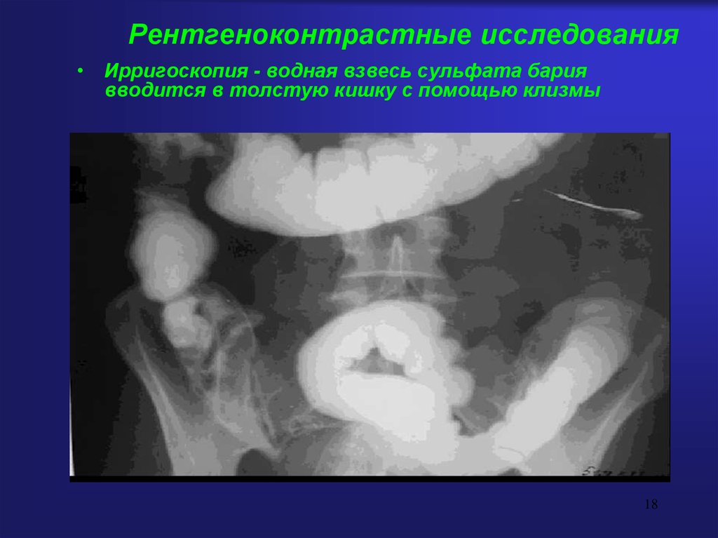 Рентгеноконтрастный барий. Рентгеноконтрастное исследование. Взвесь сульфата бария. Бария сульфат для рентгеноскопии. Рентгеноконтрастные препараты.