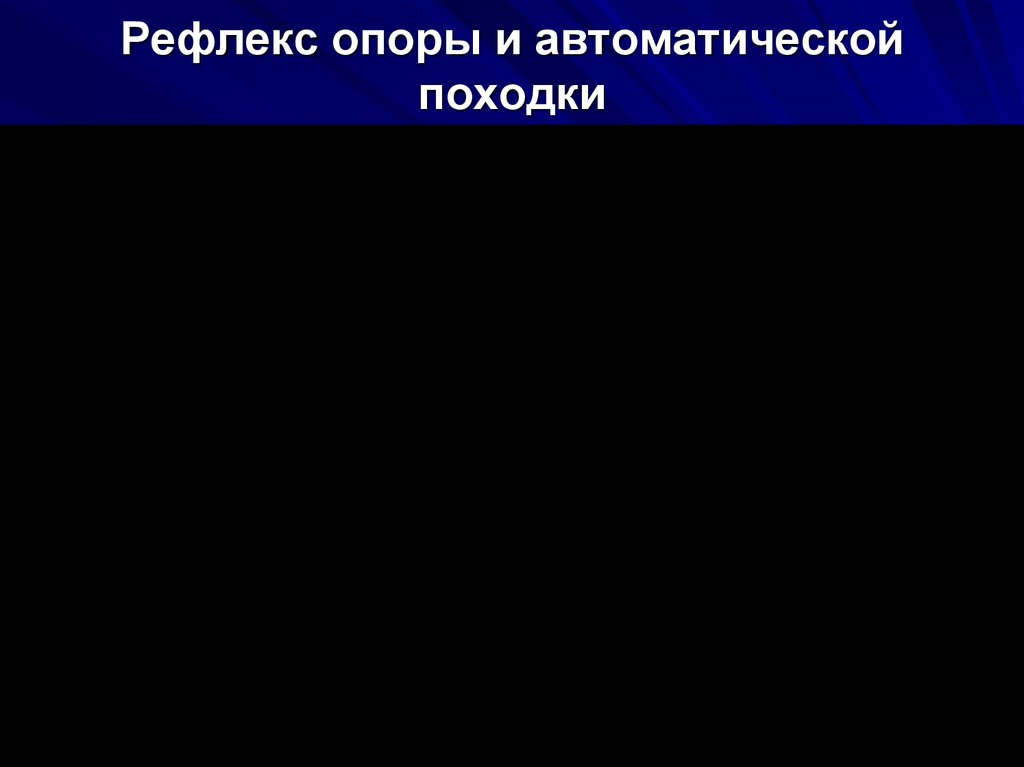 Рефлекс опоры. Опору стоп на дно и активацию рефлекса «автоматической походки.