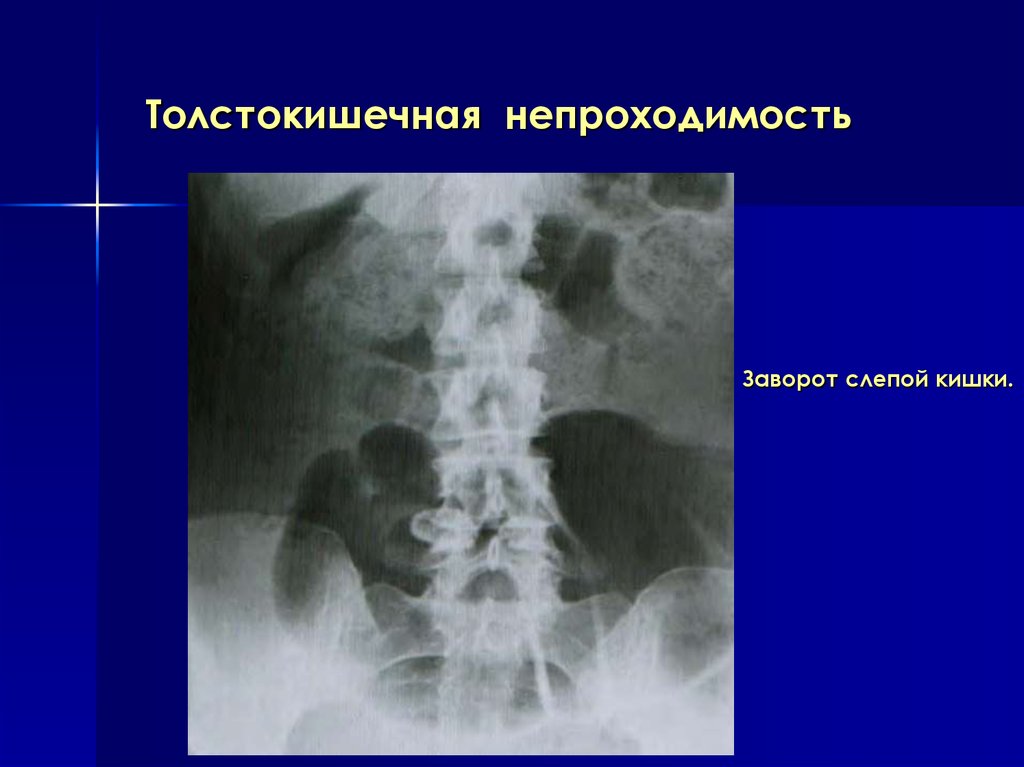 Лучевая диагностика брюшной полости презентация