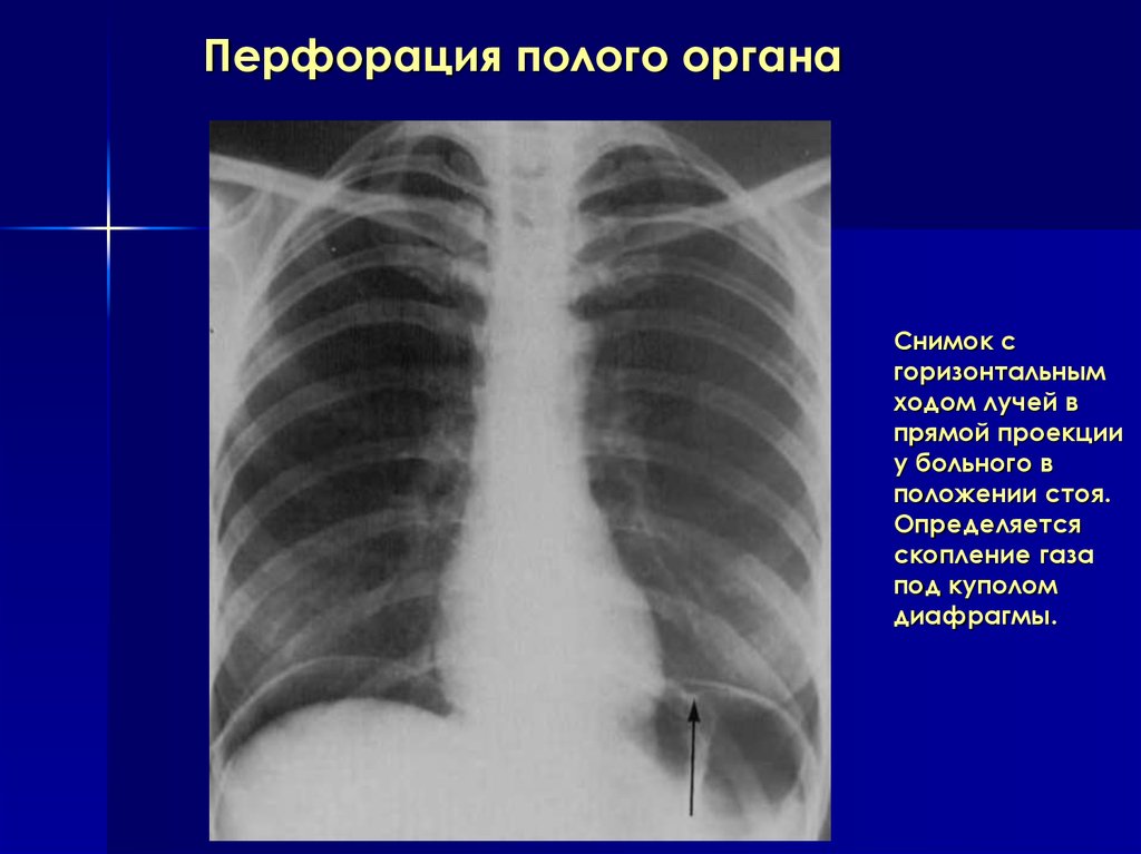 Рентген органов