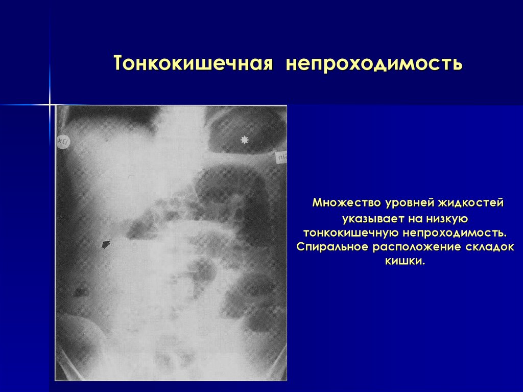 Лучевая диагностика брюшной полости презентация