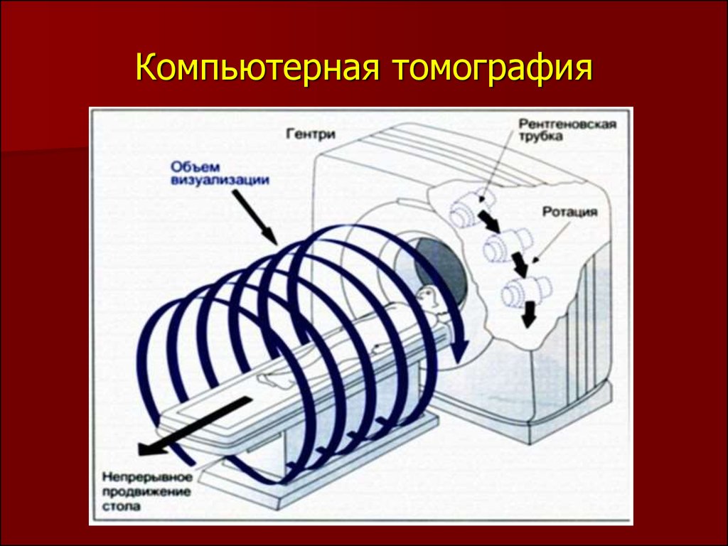 В чем заключается методика усиления при компьютерной томографии