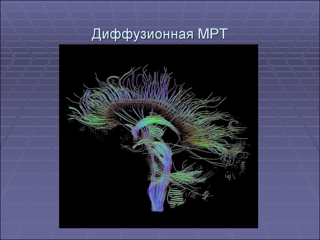 Лучевая диагностика нервной системы презентация