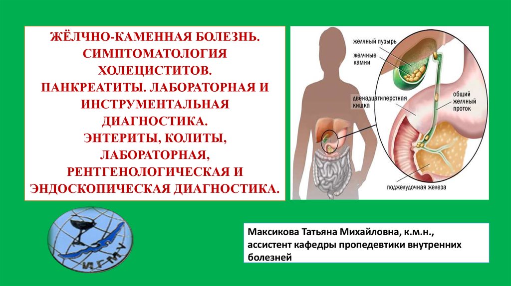 Жкб у детей презентация