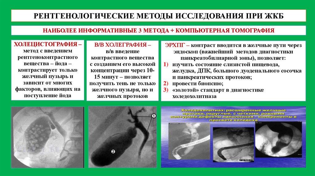 Методы исследования холецистита. Рентгенологические методы исследования желчного пузыря. Алгоритм исследования ЖКБ. Методы исследования больных с заболеваниями желчного пузыря. Рентгенологические признаки желчекаменной болезни.