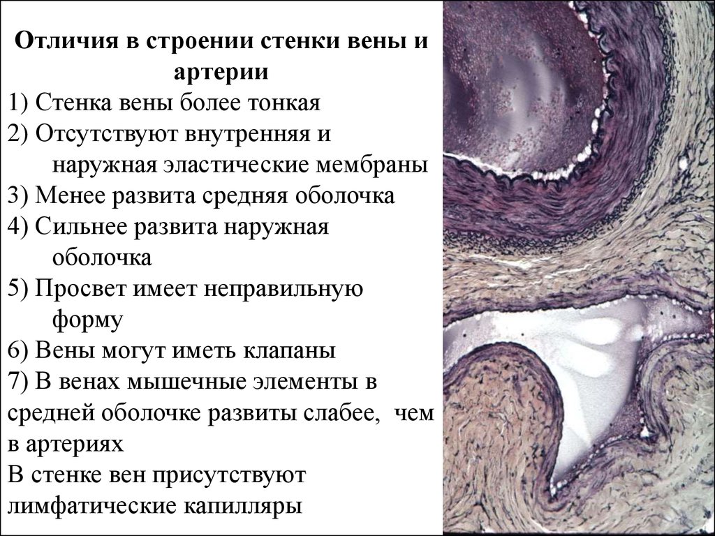 Отличие стенки артерии от стенки вен. Отличие вены от артерии гистология. Строение стенки сосуда гистология. Наружная эластическая мембрана артерии. Внутренняя эластическая мембрана.