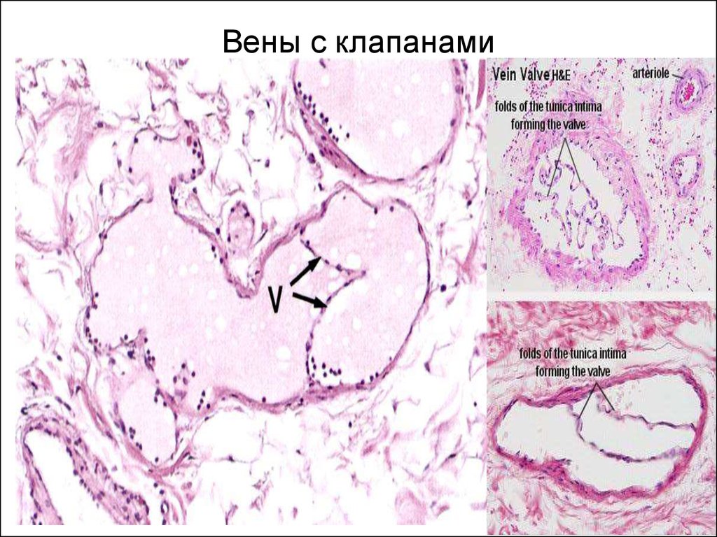 Верхняя полая вена гистология рисунок - 81 фото