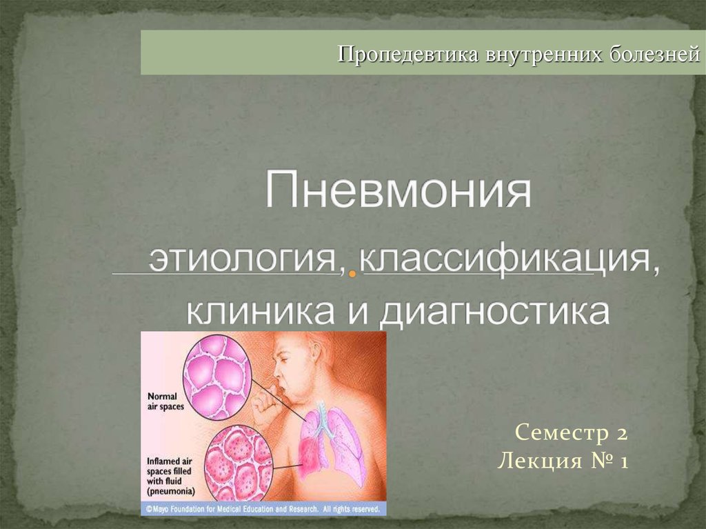 Клиника пропедевтики внутренних болезней. Этиология пневмонии. Пневмония пропедевтика внутренних болезней. Пневмония этиология классификация. Пневмонии классификация клиника.