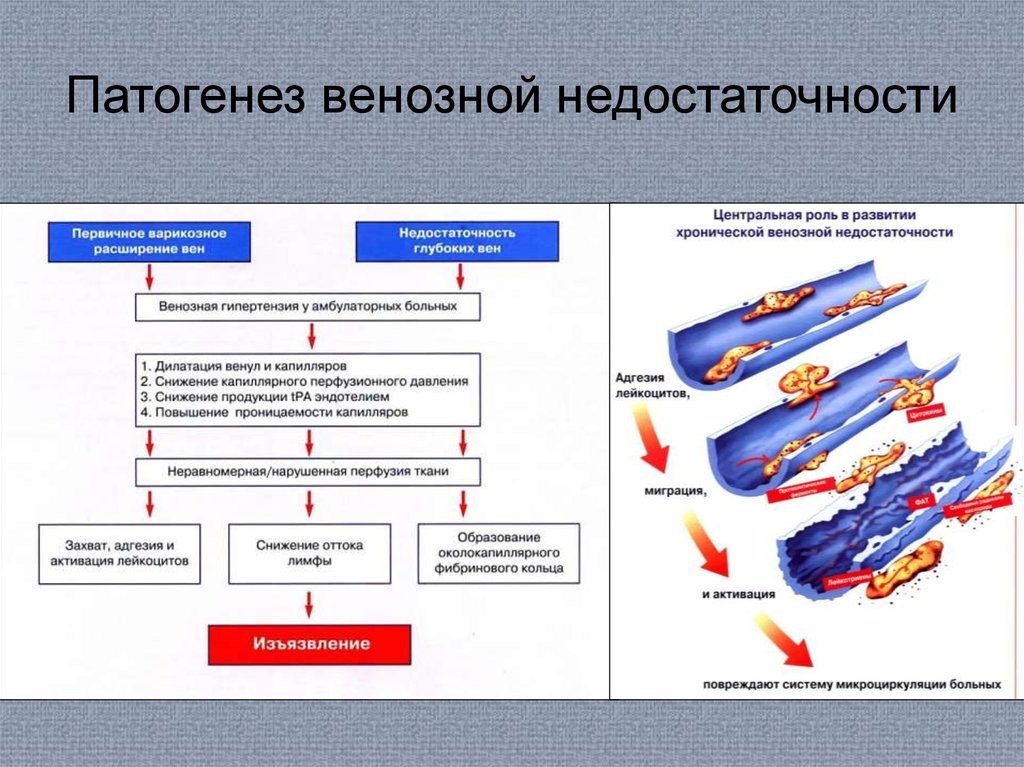 Патогенез клиническая картина