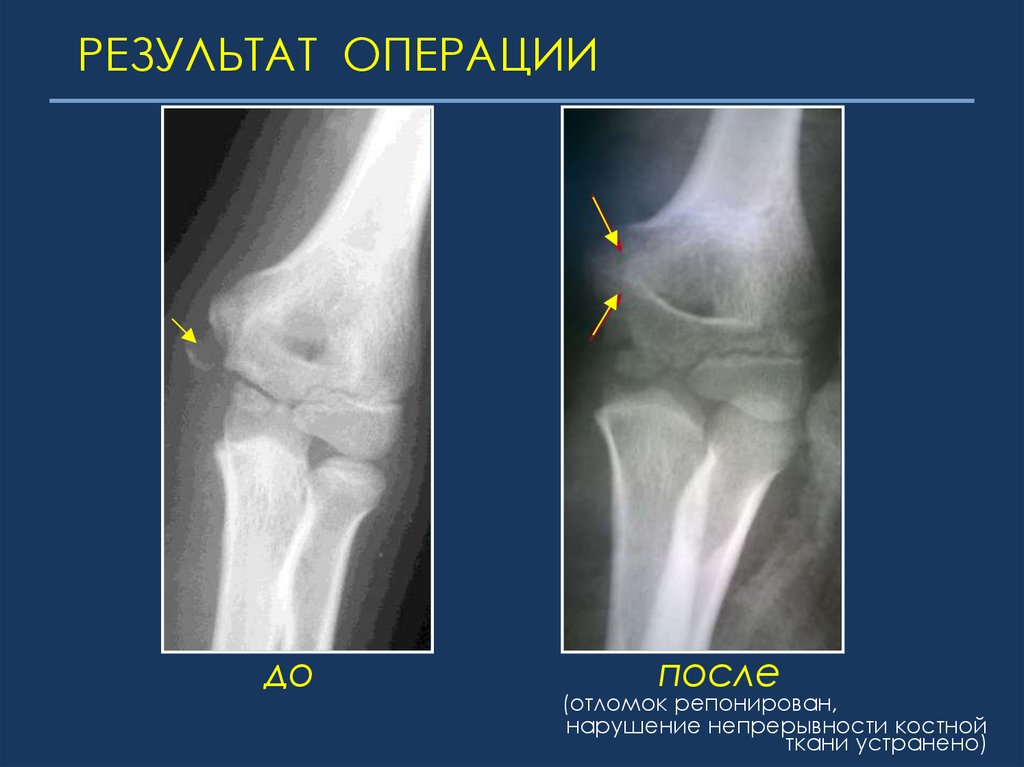 Результат операции