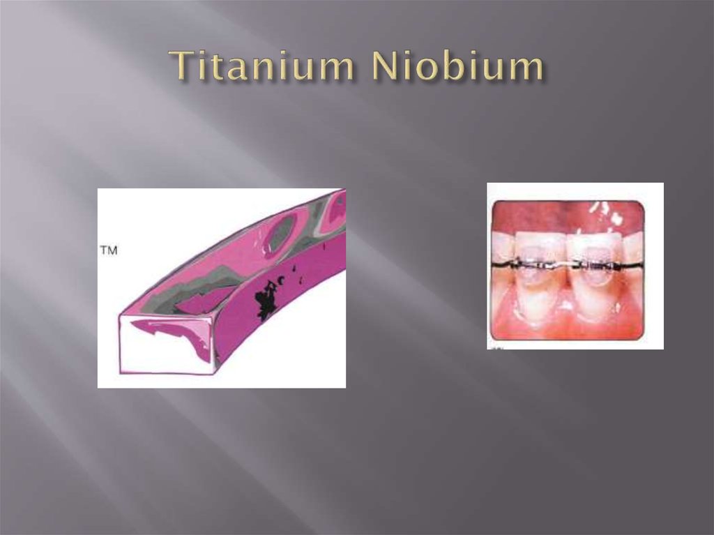 Titanium Niobium