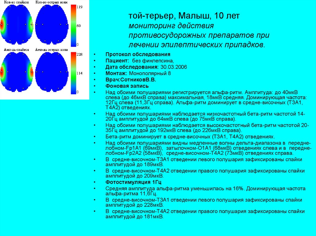 Частота 8 гц. НПД Обетми полушариямм регистртруется Альфа Ритс. Средняя амплитуда Альфа ритма. Доминирующая частота Альфа ритма. Низкочастотным бета ритмом.