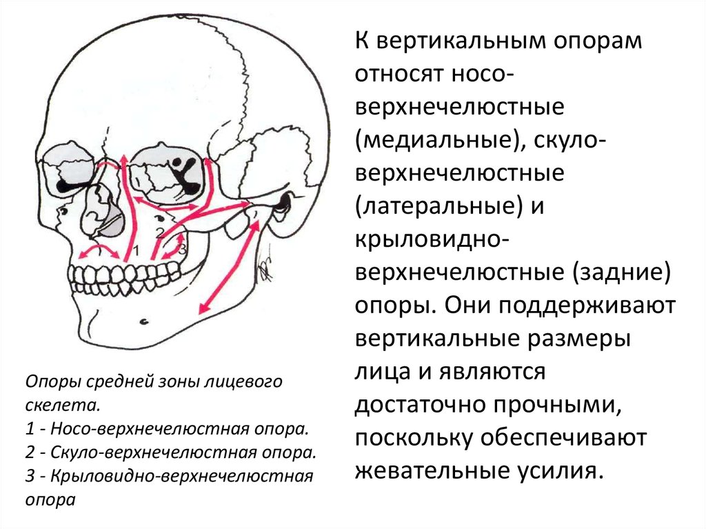 Перелом лицевого черепа. Переломы скуло верхнечелюстной зоны.. Перелом костей лицевого черепа кт. Перелом костей лицевого скелета классификация. Перелом лицевой части черепа.