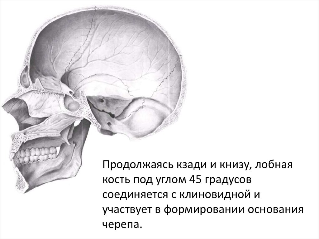 Перелом лицевого черепа. Клиновидная кость черепа перелом. Перелом клиновидной кости черепа. Соединение лобной и клиновидной кости. Перелом костей лицевого черепа.
