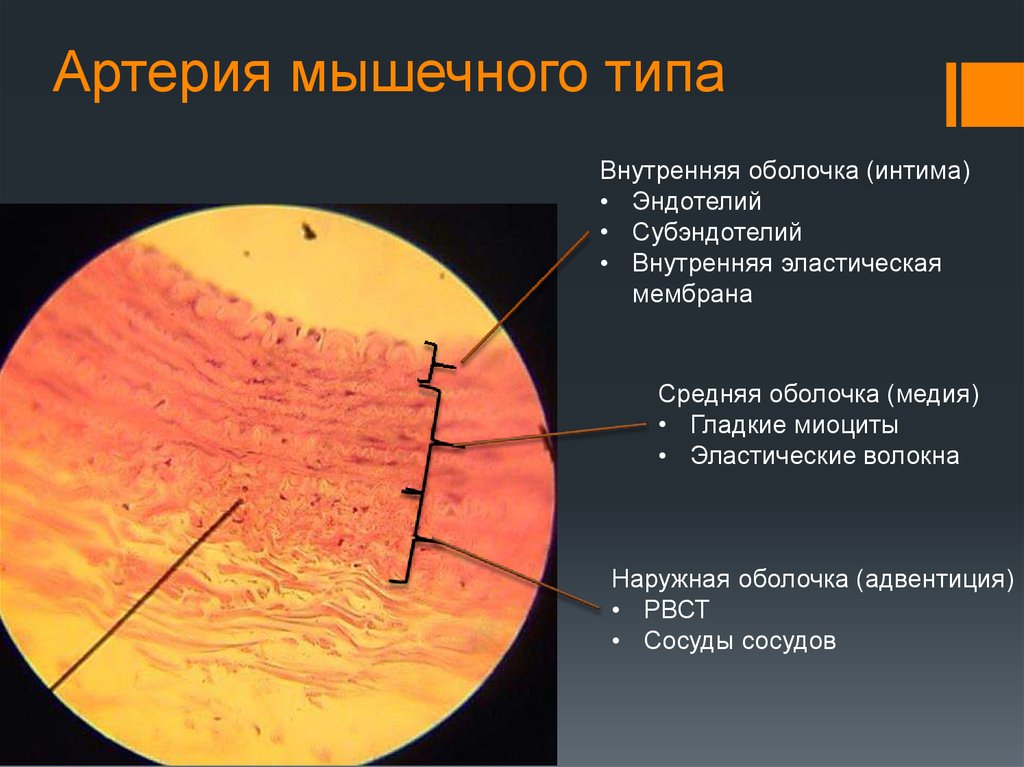 Рисунок артерии мышечного типа