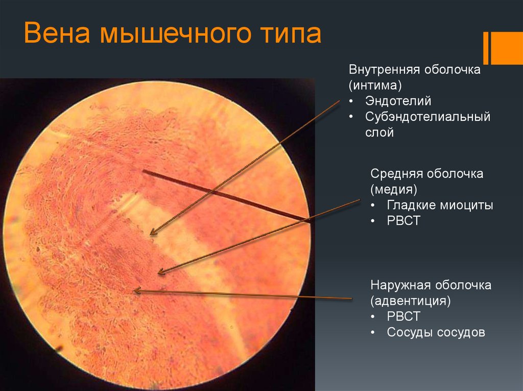 Внутренняя оболочка. Вена мышечного типа гистологический препарат. Вена мышечного типа гистология. Бедренная Вена препарат. Вена мышечного типа препарат гистология.