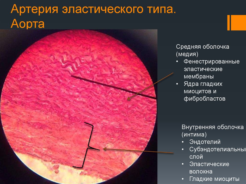 Эластичного гладкого и. Артерия эластического типа гистология. Артерия эластического типа препарат гистология. Артерия эластического типа препарат. Артерия эластического типа аорта гистология препарат.