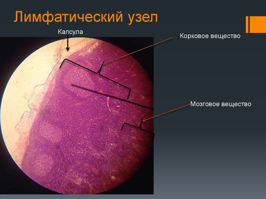 Лимфатический узел гистология рисунок с подписями