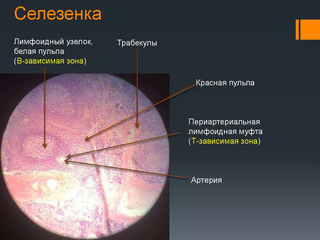 Селезенка гистология презентация