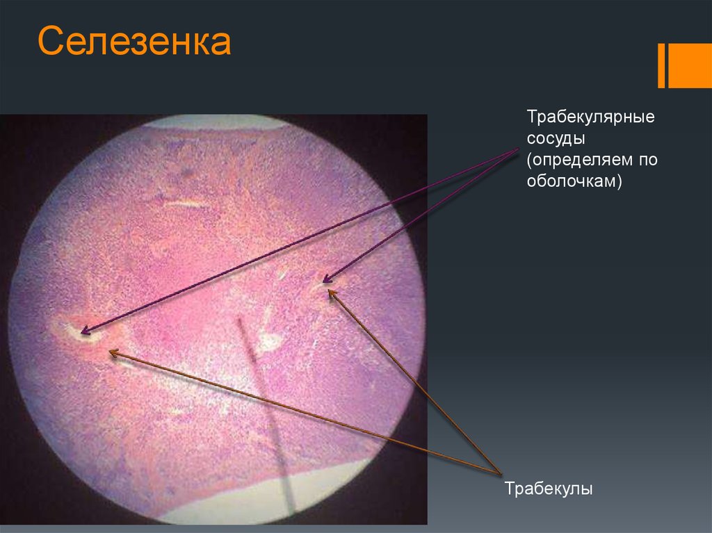 Селезенка гистология презентация