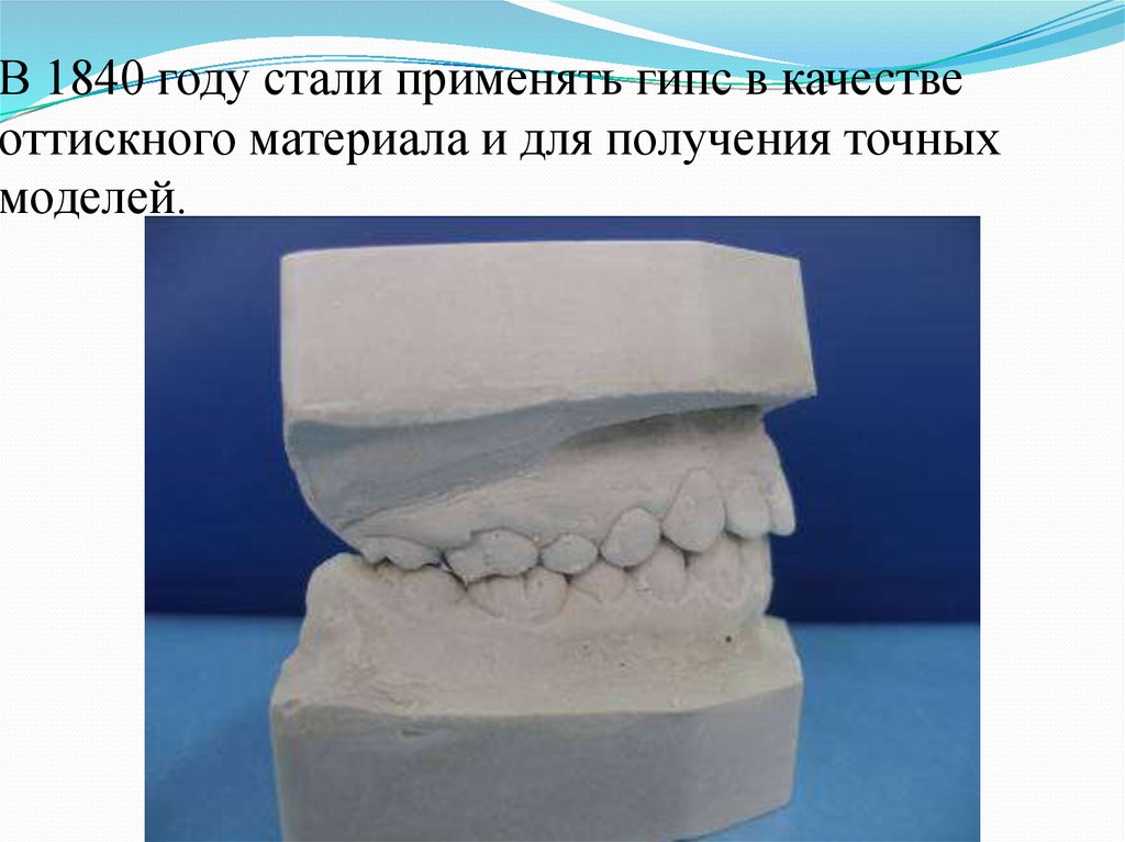Гипс в стоматологии ортопедической