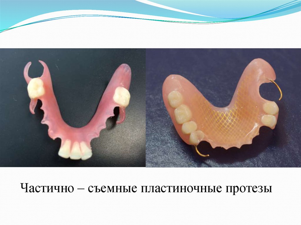 Зубное протезирование в детском возрасте презентация