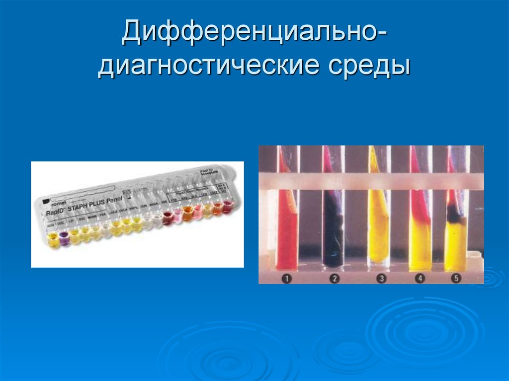 Диагностика среды. Дифференциально диагностические питательные среды среда Гисса. Дифференциальные диагностические среды микробиология. Каково Назначение дифференциально-диагностических сред?. Индикаторы дифференциально диагностических сред.