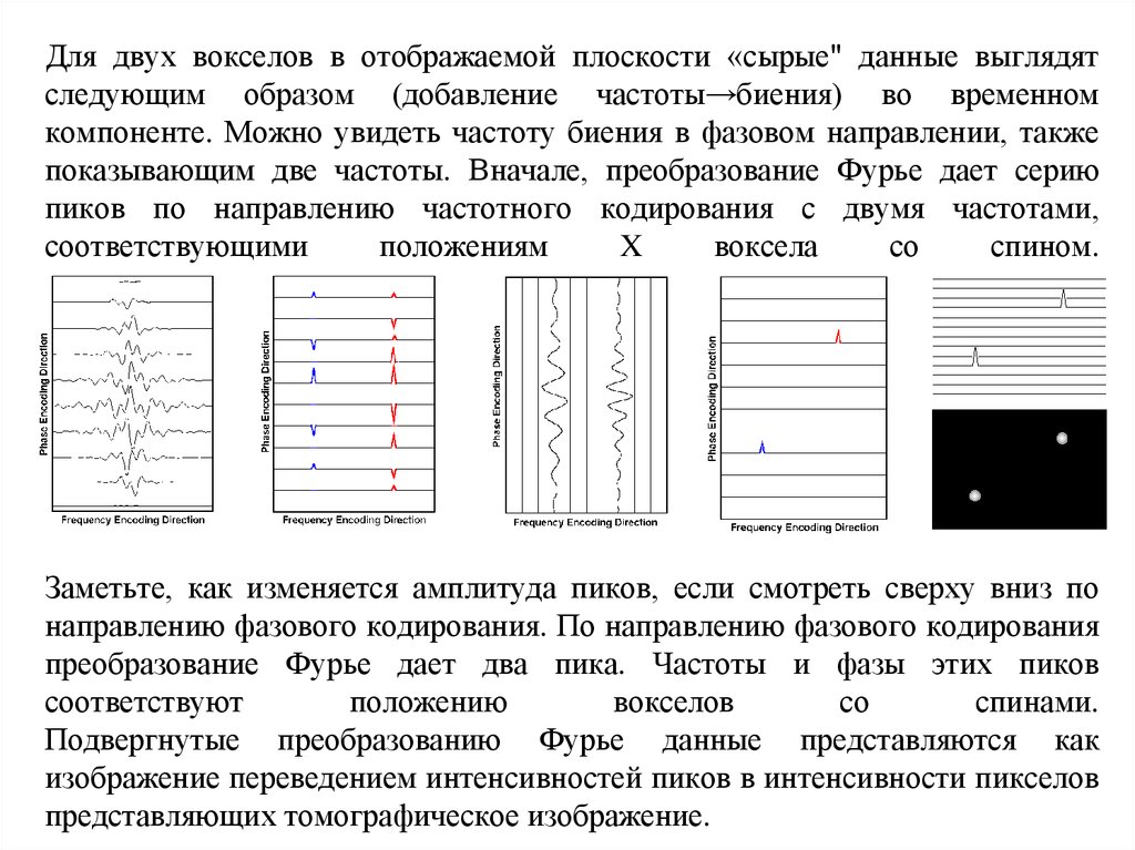 Как выглядят данные. Направление фазового кодирования. Фаза фазовое кодирование. Фазовое кодирование в мрт. Направление фазового кодирования на мрт.