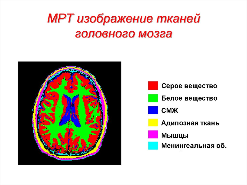 Ткани головного мозга