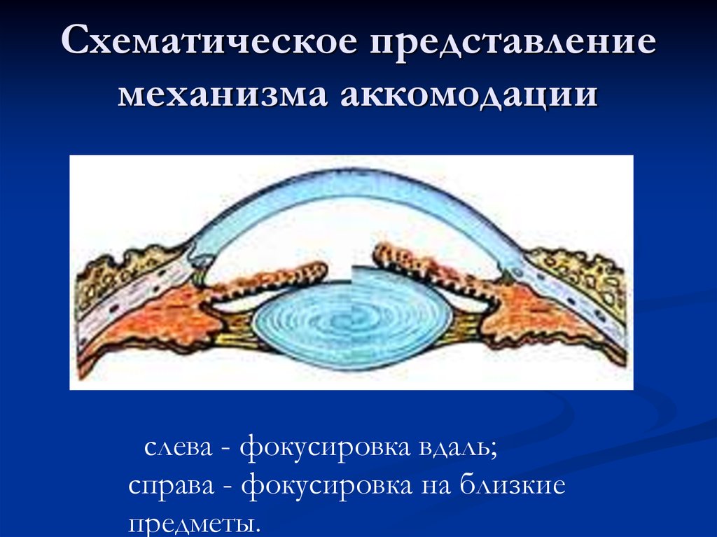 Механизм представлений. Схематическое представление механизма аккомодации. Схематическое представление механизма аккомодации слева. Физиологические механизмы аккомодации. Механизм аккомодации по Гельмгольцу.