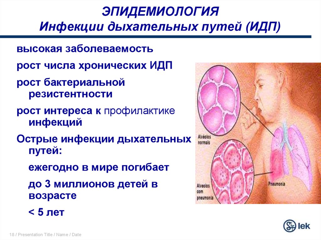 Инфекции дыхательных путей презентация