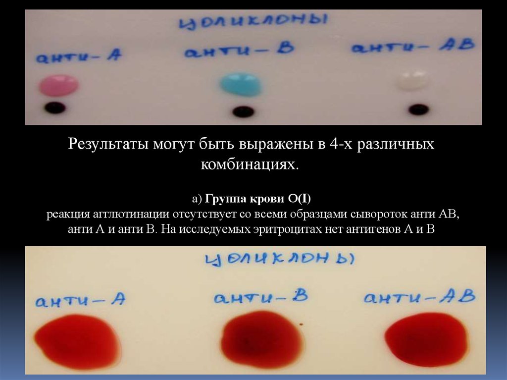 Первая группа крови голубая кровь