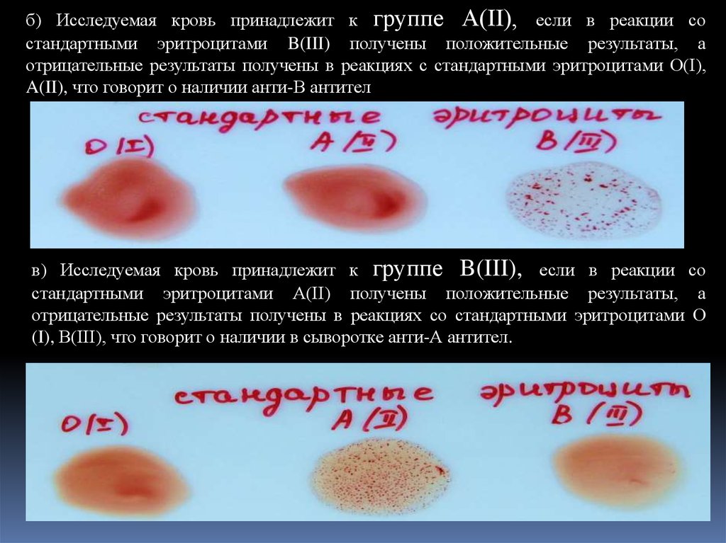 Кровь без резуса. 0 Резус-фактор крови Золотая кровь. Группы крови эритроциты. Как выглядит группа крови и резус фактор. Эритроциты 3 группы крови.